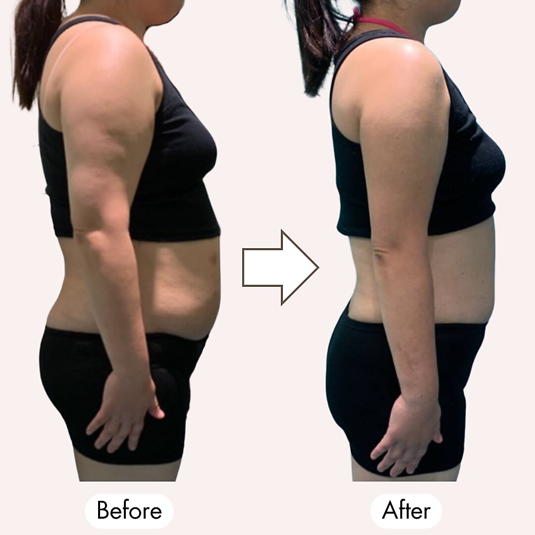 じぶんdeエステ v6 自分deエステ　スクライバー　イオン導入　ems 超音波 V6 6つの最先端機能 ｜ 定額制セルフエステの「じぶんdeエステ」公式コラム