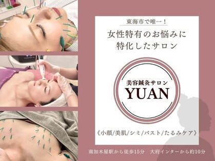 ユアン(YUAN)の写真