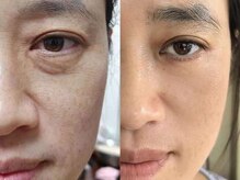 ホームサロンルビー(Home Salon Ruby)の雰囲気（丁寧なカウンセリングで、お体に合った施術をいたします。）