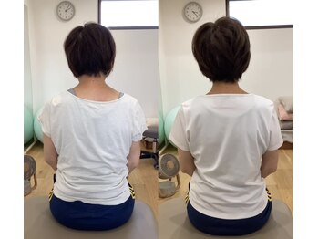 ランドル(rendre)/首下がりシンドローム