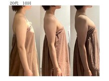 ロココ 豊田店(Rococo)/ビフォーアフター