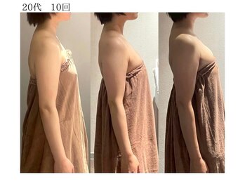 ロココ 豊田店(Rococo)/ビフォーアフター