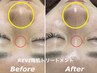 【毛穴レス最強肌質ケア】REVI陶肌トリートメント+生酵素1gプレゼント