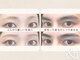 エンドアイ(&i)の写真