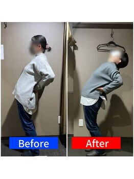 ナオル整体 仙台院(NAORU整体)/40代女性「歩く時の腰痛」