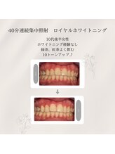 プラスビーセルフ(+b self)/ホワイトニングビフォーアフター