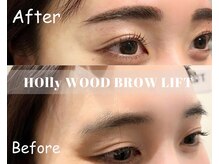 ルル(ruru)/before/after