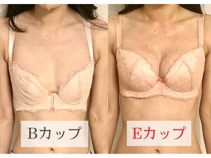 プリマ(prima)の写真