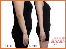 痩身館アヤ(aya)/耳つぼダイエット【富山/痩身】