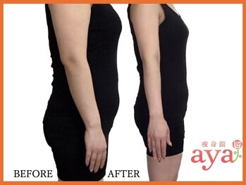 痩身館アヤ(aya)/耳つぼダイエット【富山/痩身】