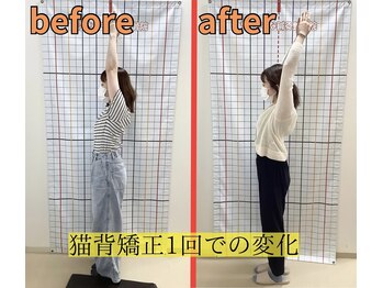 きずな鍼灸整骨院 武蔵ヶ丘本院/猫背矯正