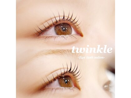 トゥウィンクル(twinkle by HARVeST)の写真