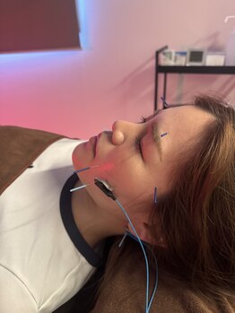 ハリファ鍼灸院 熊本光の森院(HariFa鍼灸院)/美容鍼