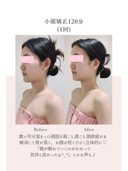 トゥインクル 麻布(twinkle)/港区/南麻布/白金高輪/小顔矯正