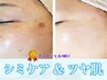 限定価格【ケシ〇ンじゃ消えない】シミケア5回コース！若かった頃のツヤ肌へ