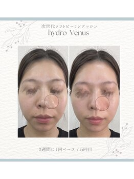 プティリッシュ(Petit Rishe)/ハイドロヴィーナス