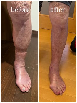 メル(MeRu)/年末年始のSOS、90才の父をケア