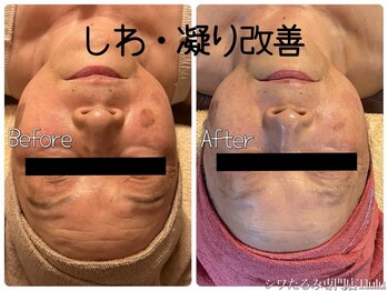 トルル(Tlulu)の写真/40・50代からのオトナ女子向けサロン★諦めていたシワたるみを改善!みるみる変わる若々しい見た目に驚き!