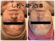 トルル(Tlulu)の写真/40・50代からのオトナ女子向けサロン★諦めていたシワたるみを改善!みるみる変わる若々しい見た目に驚き!