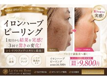 ラヴィアンローズ 岐阜本店(La vie en Rose)/6回のピーリング