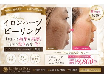 ラヴィアンローズ 岐阜本店(La vie en Rose)/6回のピーリング