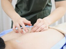 【本格整体&鍼灸マッサージ】健康堂整骨院 溝の口本院の雰囲気(手技では届かない深部のコリや自律神経の乱れに直接アプローチ♪)