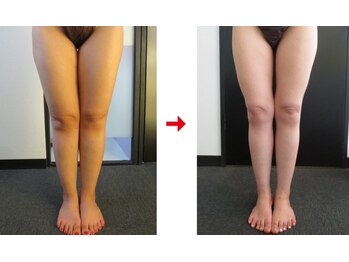 フォーレディ 恵比寿店/痩身★ふくらはぎ-5.2ｃｍ↓↓↓