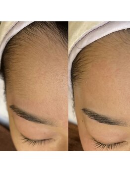 シルドゥリーナ(cil de rina)/マリムーブフェイシャルワックス