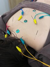 ハリマジック 代官山(HARI MAGIC)/【代官山/鍼灸/美容鍼】