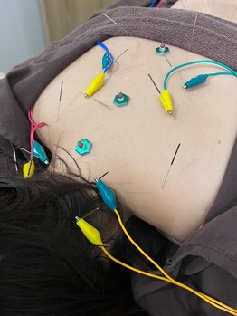 ハリマジック 代官山(HARI MAGIC)/【代官山/鍼灸/美容鍼】