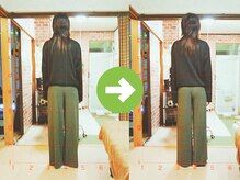 サプライズ整体院/30代ママの初回産後の骨盤矯正