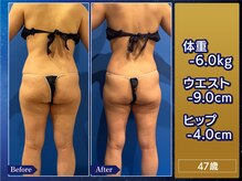 プリオール 高崎花水木店(Prior)の雰囲気（痩身フォトコンテスト開催｜-6kg達成実績ありサイズ変化◎）