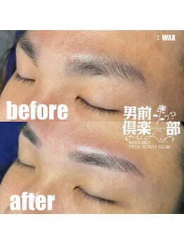 男前倶楽部/脱毛/メンズ脱毛/メンズ専門店