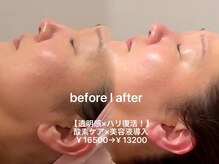 ソワン ド ブランシュ ライフ八戸ノ里店(Soin de Blanche)/【透明感xハリ復活！】