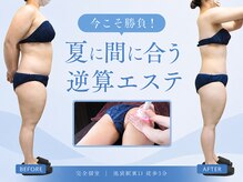 エステティック レイビス 池袋店(RAYVIS)
