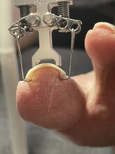 トゥーネイル(02nail)/