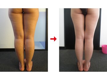 フォーレディ 恵比寿店/美脚★痩身エステ