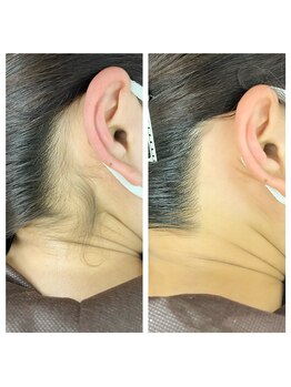 ヴェリー(Very)/うなじワックス