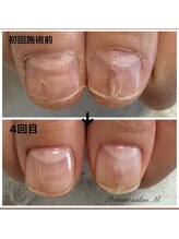 プライベートサロンエム(M)/自爪育成クリアジェル　¥6000