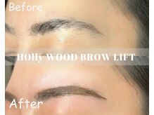 ルル(ruru)/before/after