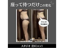 スタジオ エン(STUDIO EN)の雰囲気（蒸されてわかる"若よもぎ蒸し"毛穴ケア・美肌ケアに◎）