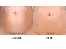 ブリリアンス(BRILLIANCE)/お肌の改善に効果的！！