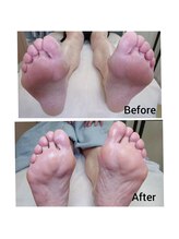 リゼラアンドコー 上越店/ドイツ式フットケア専門店