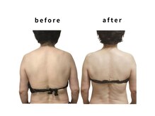 リカバリー(&recovery)/肩甲骨剥がし＆背肉のrecovery