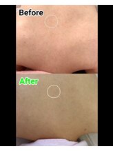 ビューティーサロン アンジェリーク