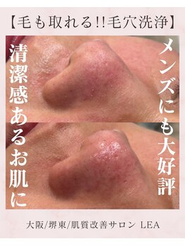 レア(Lea)/男性の方にも大好評＊