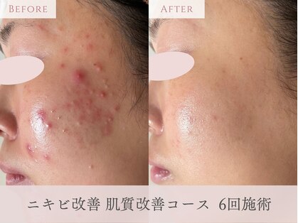 レフルール 梅田店(Les Fleurs)の写真