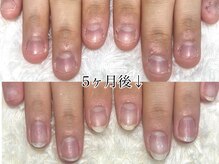 グラシナ 名古屋金山店/(深爪／長さだし/フィルイン)