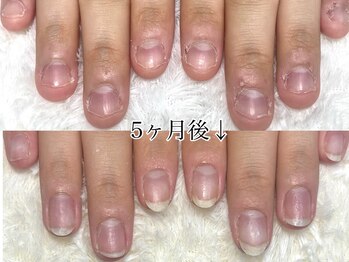 グラシナ 名古屋金山店/(深爪／長さだし/フィルイン)