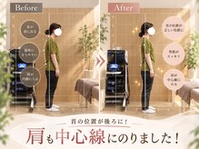 栄光治院　岡崎本院ll 【肩こり/腰痛/骨盤/猫背/産後/頭痛/肩甲骨はがし】